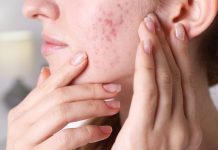 Ove tri bolesti se najčešće nasljeđuju od roditelja