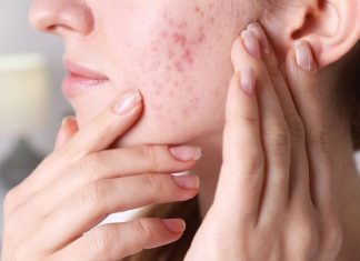 Ove tri bolesti se najčešće nasljeđuju od roditelja