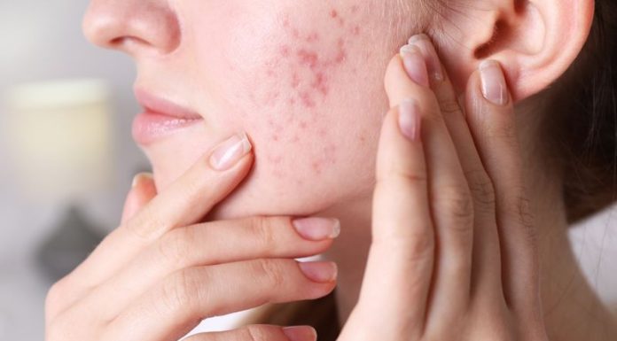 Ove tri bolesti se najčešće nasljeđuju od roditelja